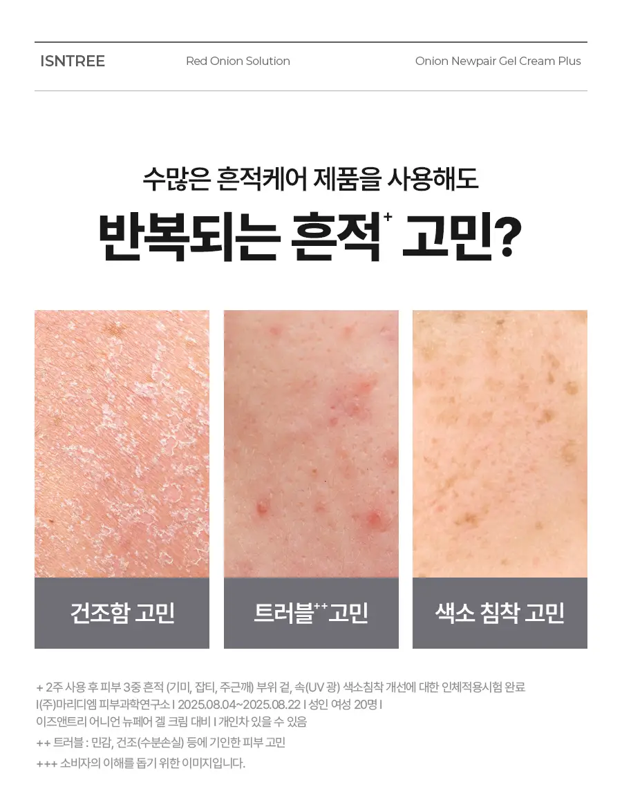 [NCT 재민PICK] 이즈앤트리 어니언 뉴페어 겔크림 플러스 50ml 기획 (+겔크림 플러스 20ml, 패드 2매) 상세페이지 18